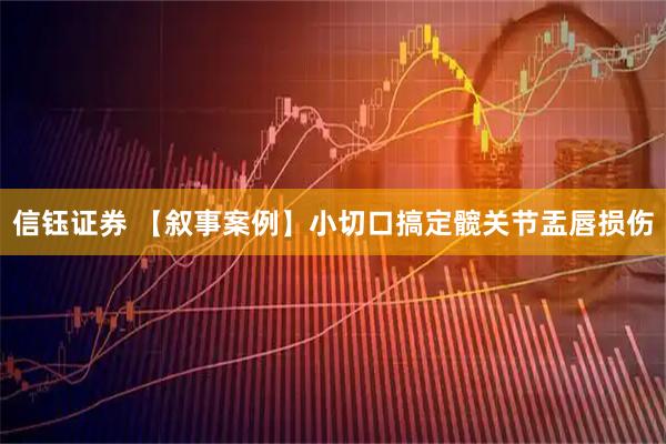 信钰证券 【叙事案例】小切口搞定髋关节盂唇损伤